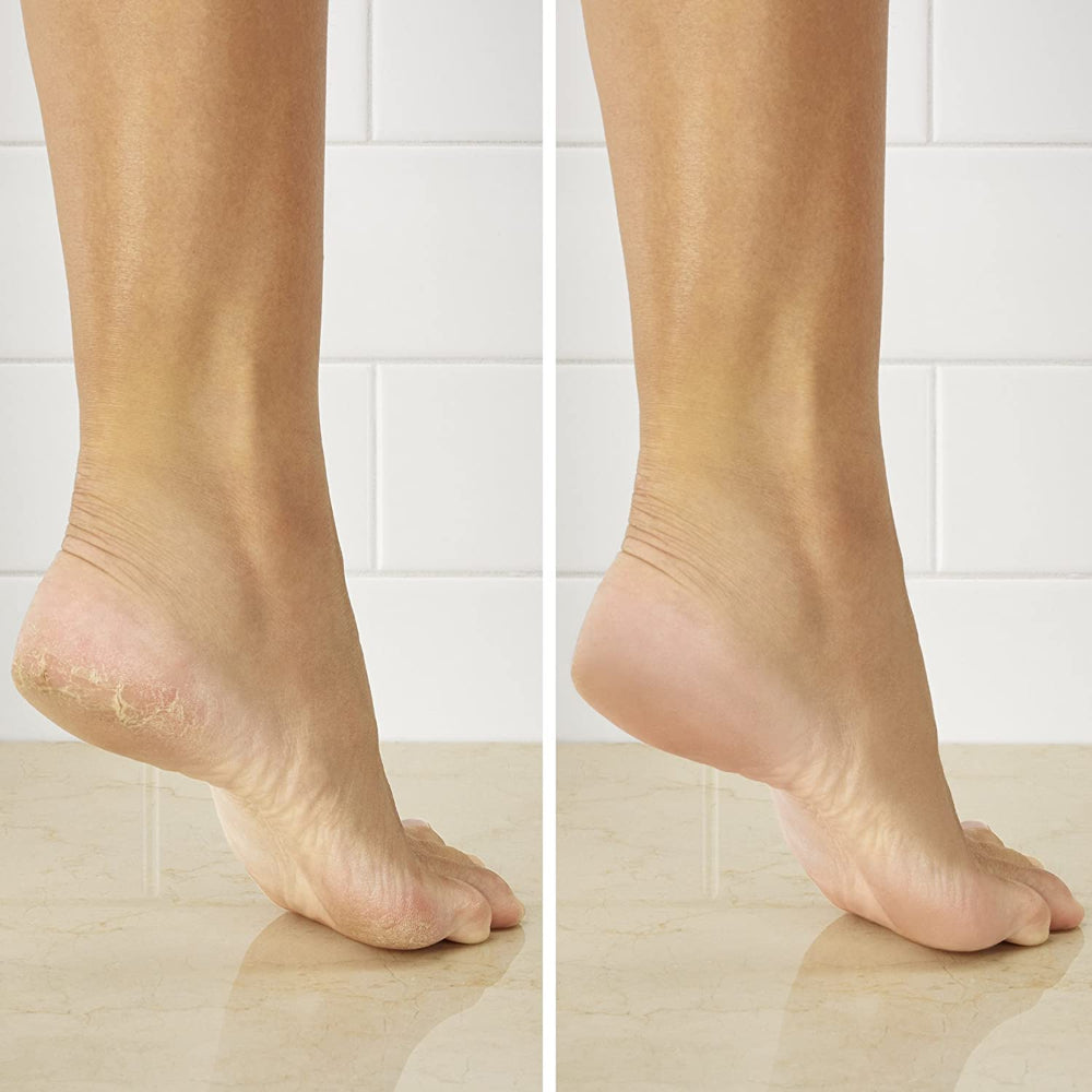 Removedor de Callos PED1 de True Glow by Conair®_005
